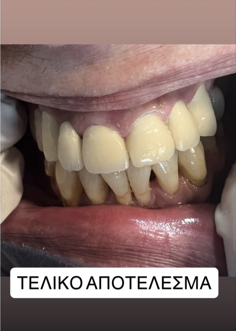 εικόνα Viber 2026 03 29 18 30 45 470